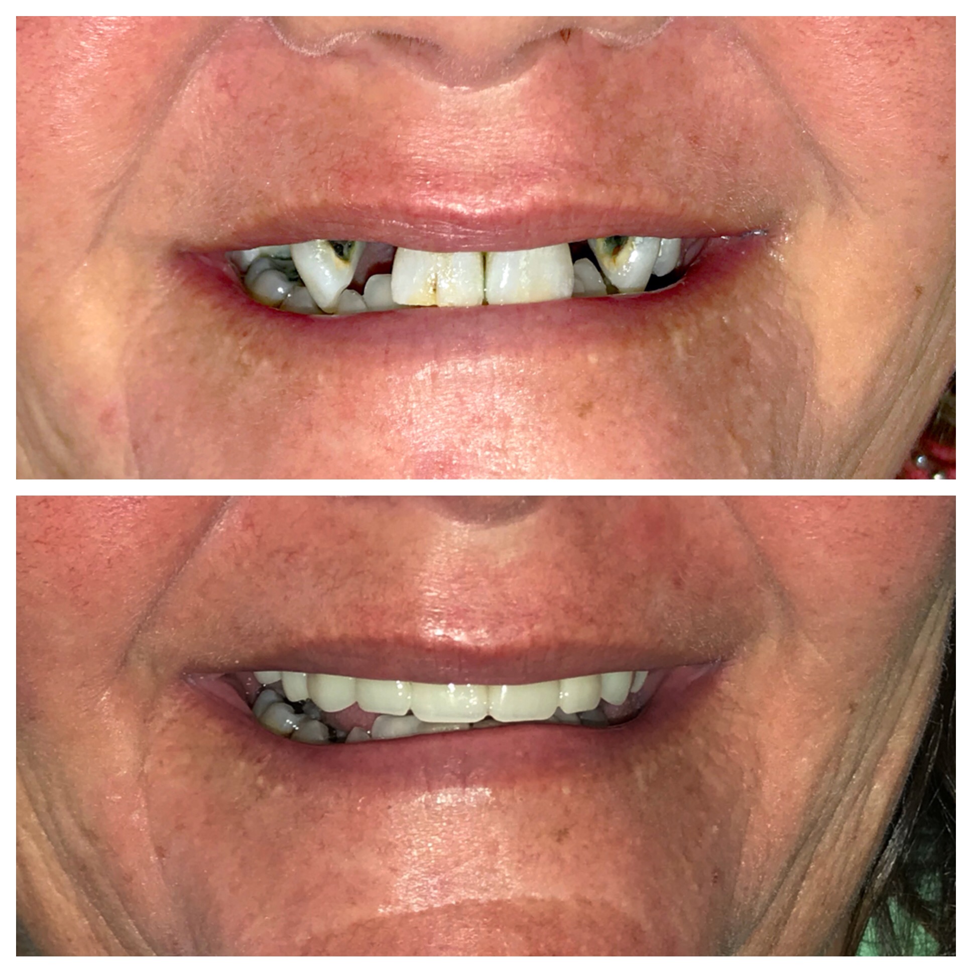 Smile Gallery DentureCare and Implant Solutions Rocky Mount NC