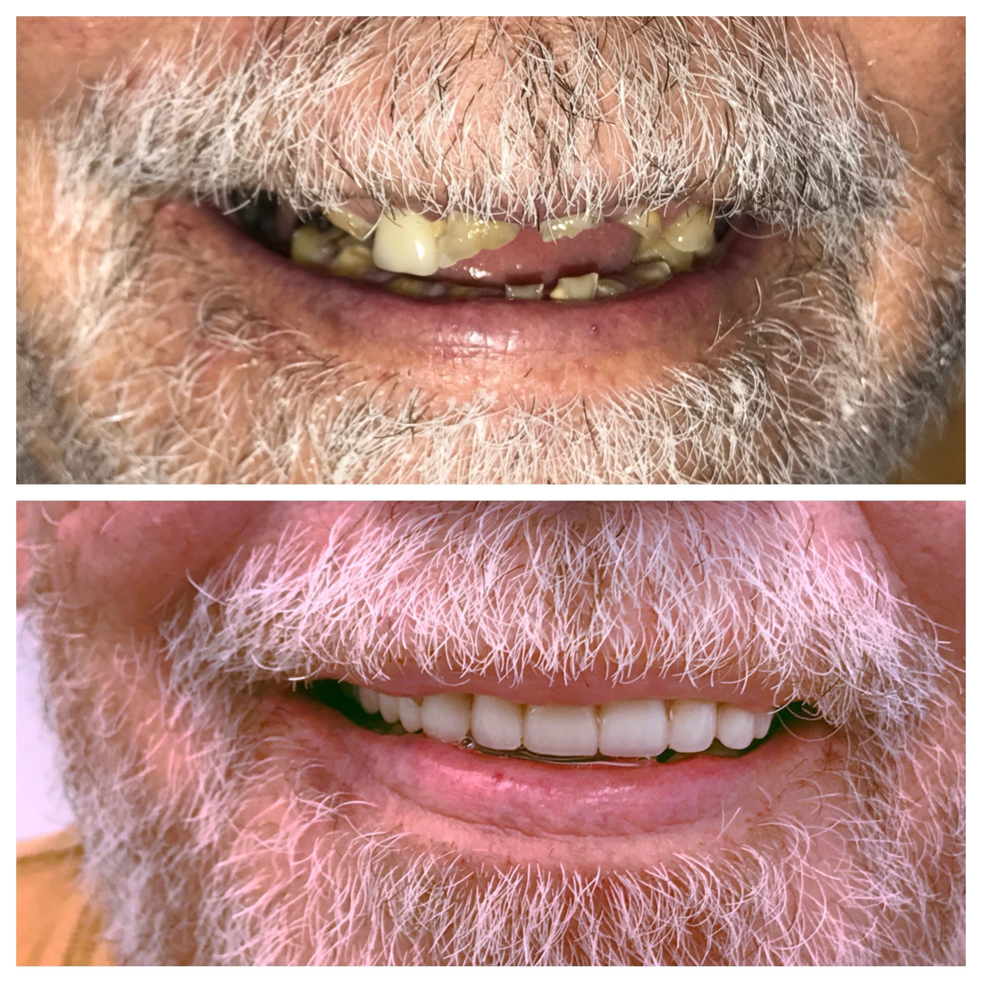 Smile Gallery DentureCare and Implant Solutions Rocky Mount NC